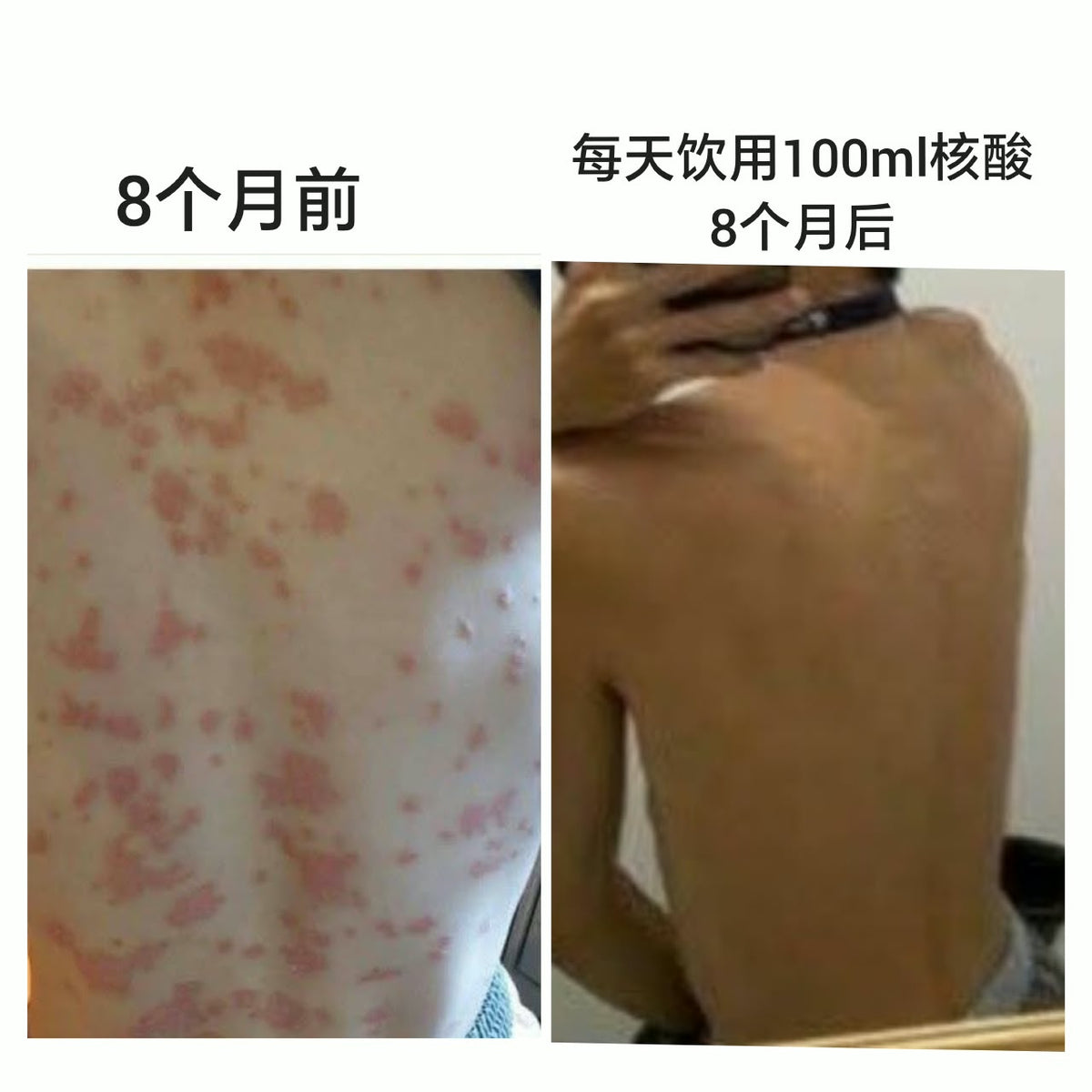 Fordays Japan DNA Collagen