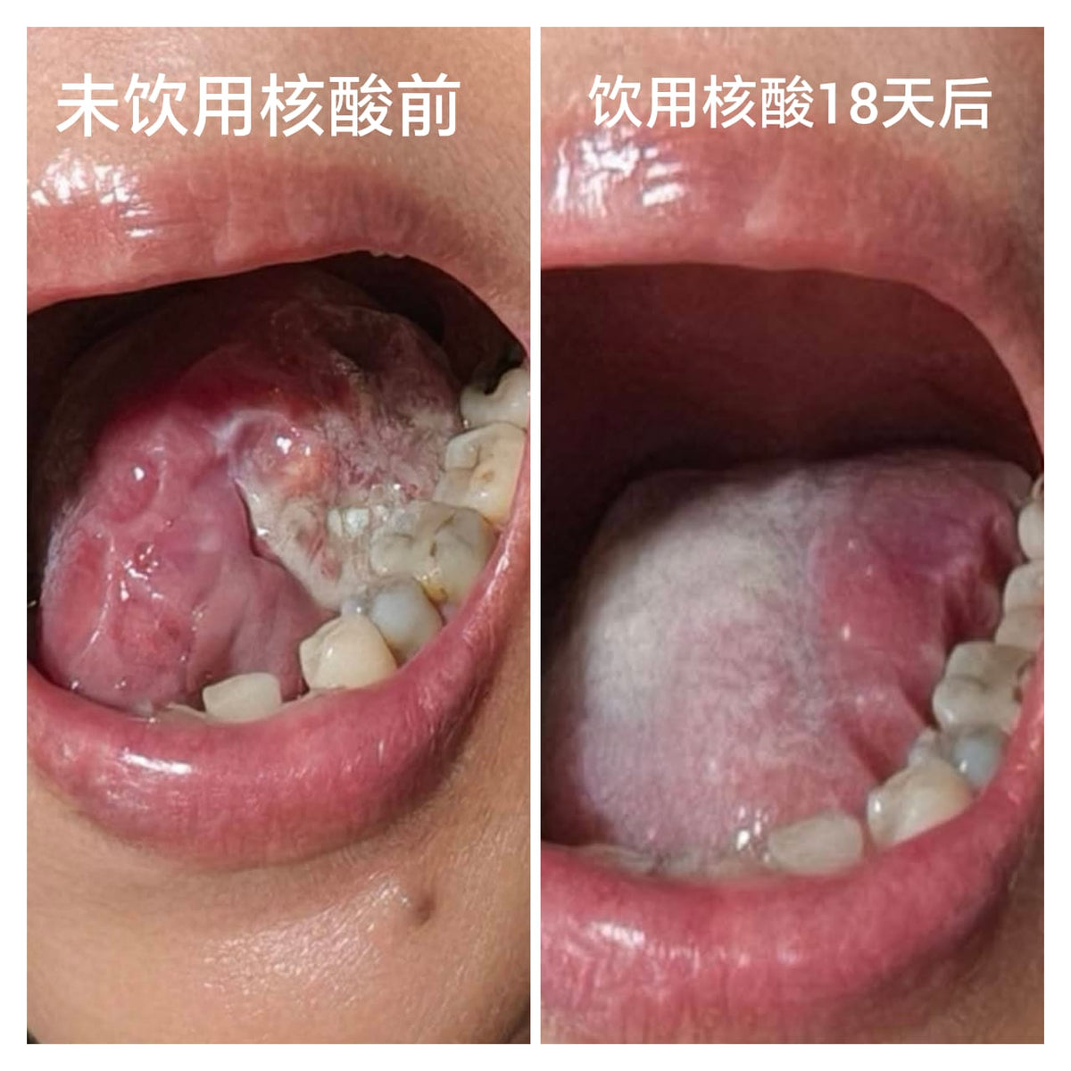 Fordays Japan DNA Collagen