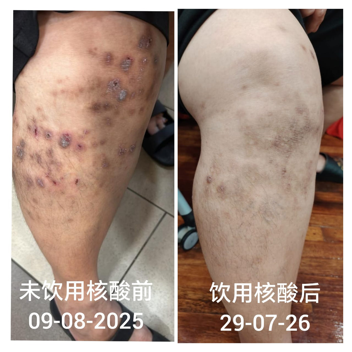 Fordays Japan DNA Collagen